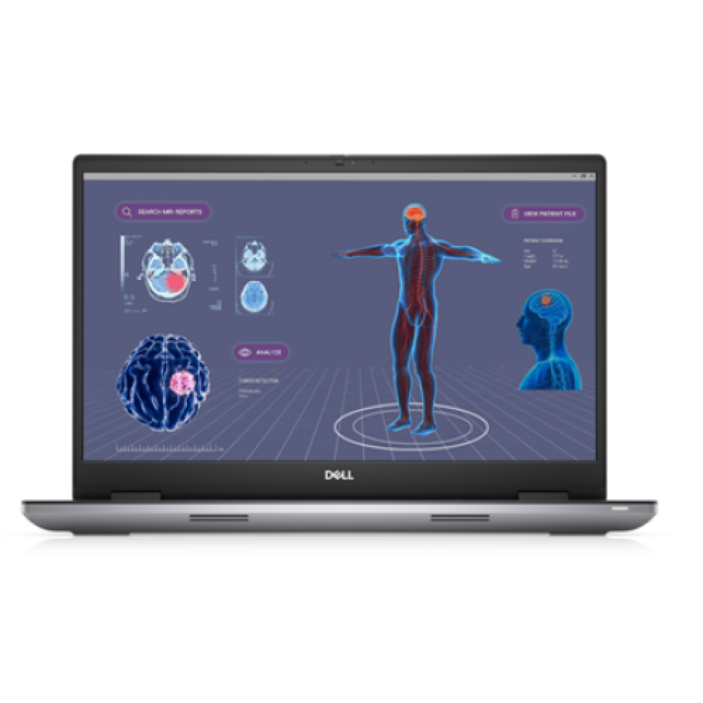 Dell Mobile Precision 7780 Grey 17.3 WVA FHD 1920 x 1080 pixels Anti-glare Intel Core i9 i9-13950HX SSD 32 GB SODIMM SSD 1000 GB NVIDIA RTX 3500 Ada Windows 11 Pro 802.11ax Keyboard language English Keyboard backlit Warranty 36 month(s) Battery warranty 1